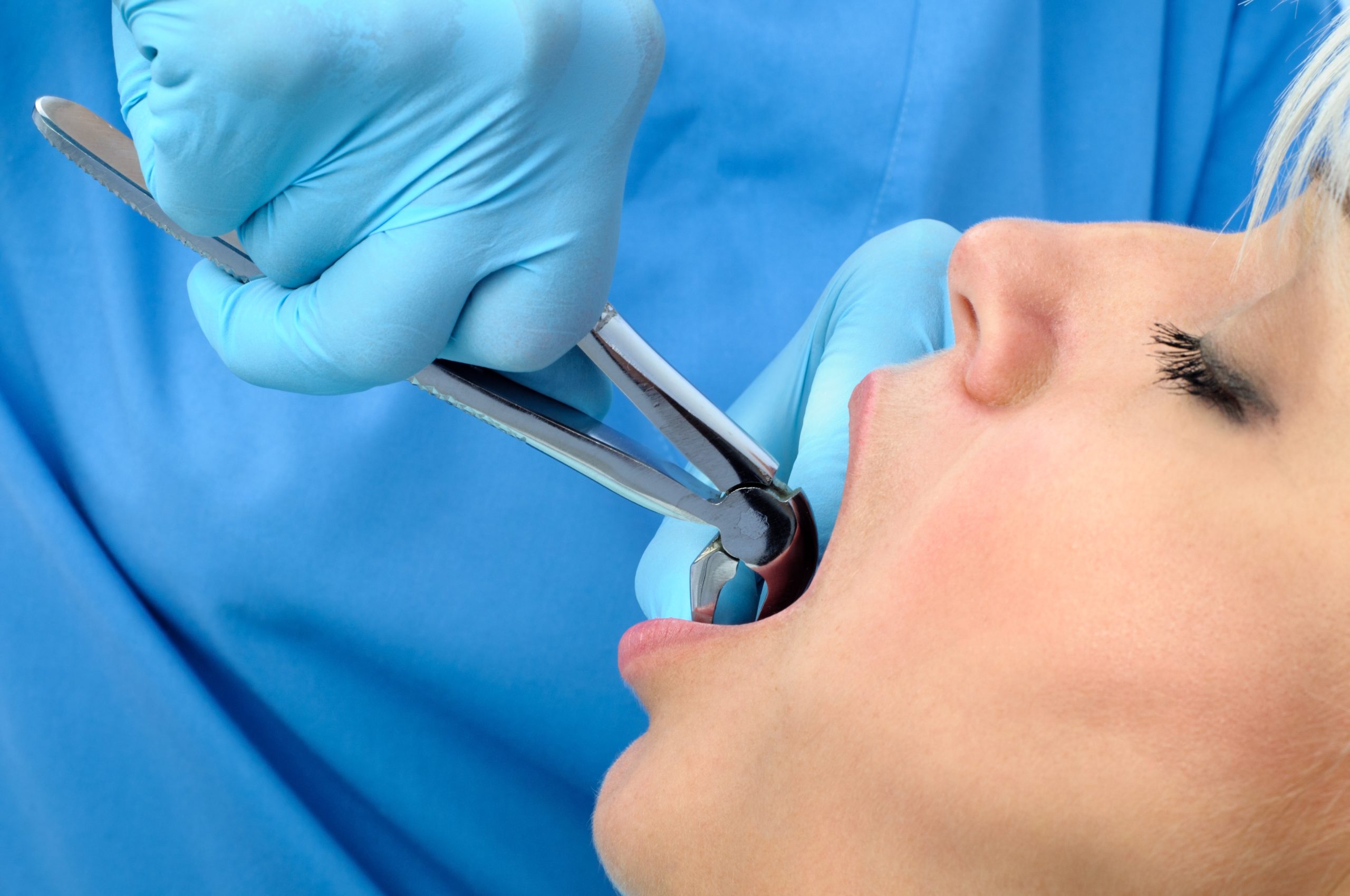 Tooth implant surgery in a North York dentistry