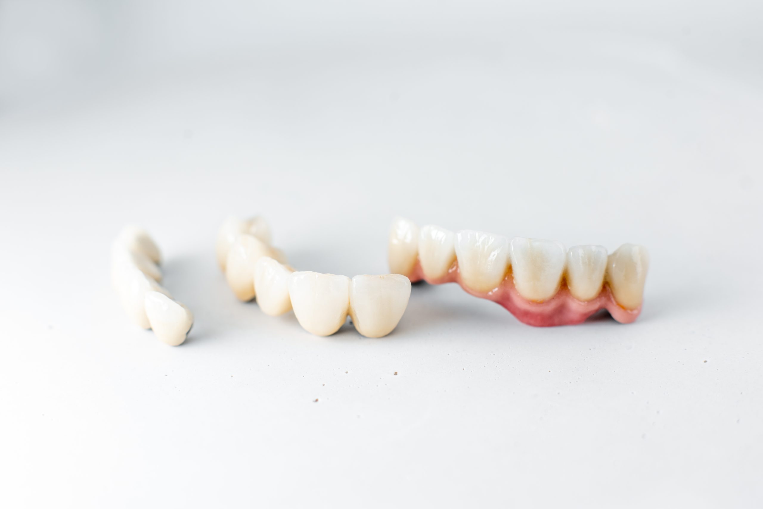 Dental crowns in a North York dentistry