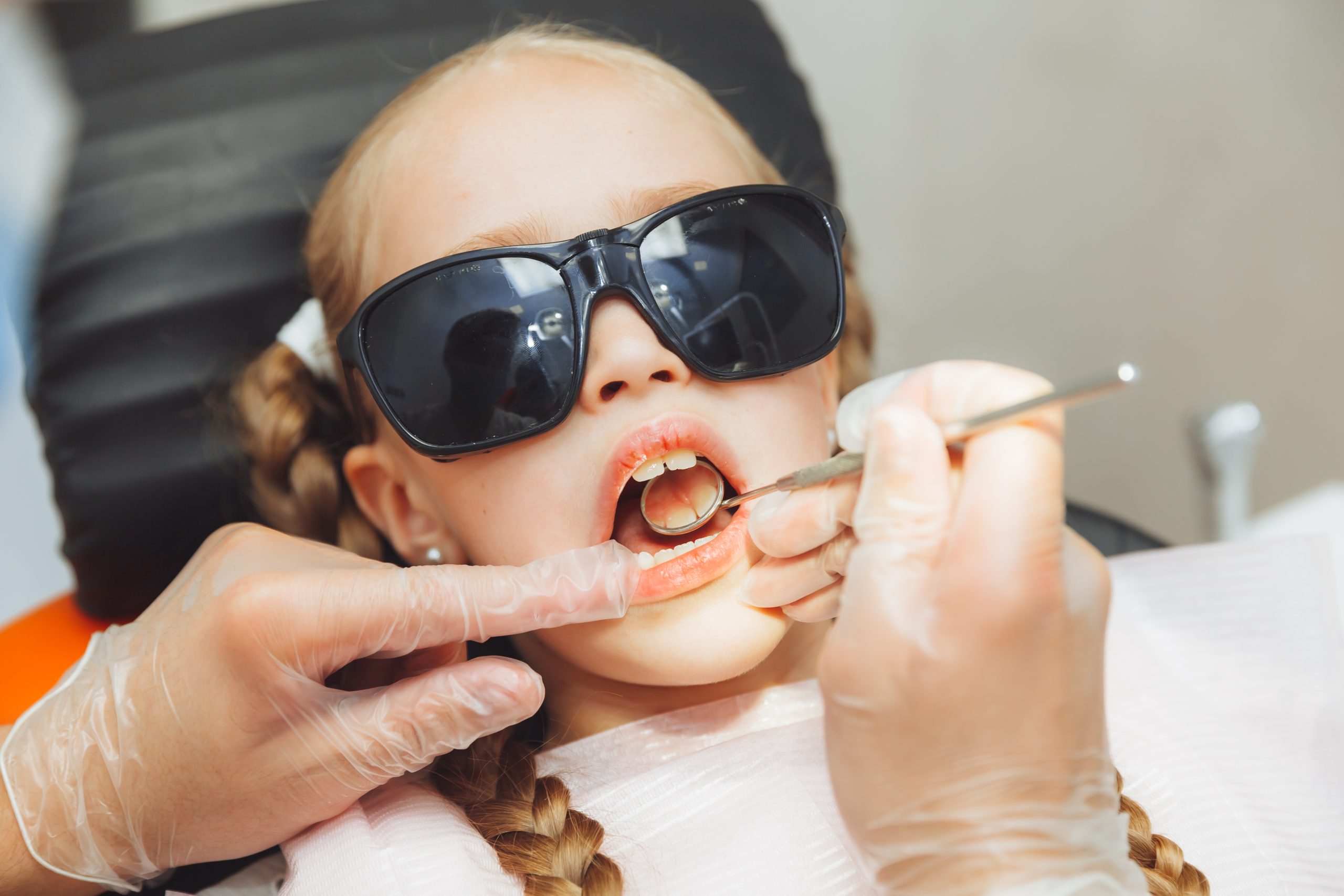 Teeth bonding in a North York dentistry