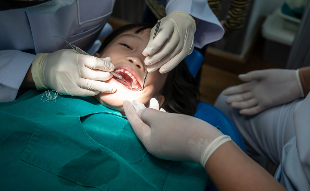 Teeth filling in a North York dentistry