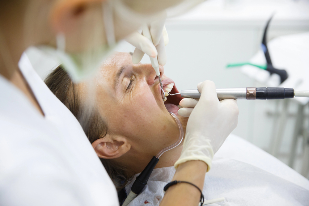 Teeth bonding in North York